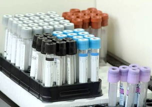 4款医疗器械产品被核查召回 行业监督抽查成常态